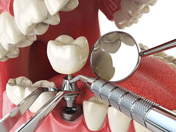 Best Emergency Treatment for Jaw Pain or Injury in New Brighton, MN